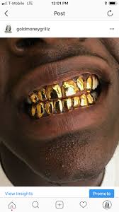 Check spelling or type a new query. Npg Dental Gold 60n6 Dip In 24k Goldmoney