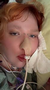 How long does it take to get biopsy results for tongue cancer?