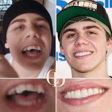 So that's how they eat homework 😂✨ #goldenretriever #denture #repost  @dentistry.blogg . . . . . #dentistry #dentist #teeth #cosmeticdentistry  #medicine #beauty #doctor #aesthetics #cosmetics #health #surgery  #plasticsurgery #odontologia ...