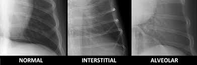 They did a cat scan and said the nod was.08 or 08 centimeters in dia. Radiographic Approach To The Coughing Pet Mspca Angell