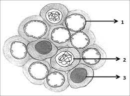 It debuted in 1924 and climbed to rank number one on a poll by fortune in 1937. Orphan Annie Eye Nuclei Bavle Rm J Oral Maxillofac Pathol