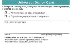 Check spelling or type a new query. Organ Donation Alberta Doctors Digest