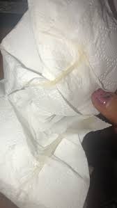 Mucus Plug 39 Weeks Mumsnet