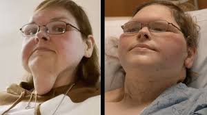 SAD UPDATE!! Tammy Slaton Can't Hold Back Her Tears As She Faces The Mirror  Post-Surgery!