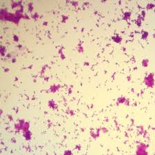 The spores, in contrast, are extremely resistant to heat and the usual antiseptics. Amazon Com Clostridium Tetani W M Microscope Slide Electronics