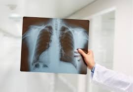 The majority of the metrics point to this investment being highly attractive. Relief Therapeutics Submits Ind For Phase 2 3 Clinical Trial Of Rlf 100 Targeting Early Covid 19 Lung Injury