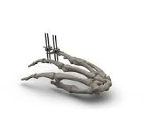 Modular external fixation system - TASARIMMED ...