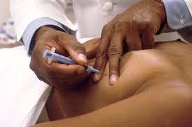 The breast is enlarged (often of relatively short onset), indurated, erythematous, warm, and may be histologically, the dermal lymphatic invasion is pathognomonic of inflammatory breast cancer but does not necessarily need to be demonstrated to. Breast Cancer Biopsy Wikidoc