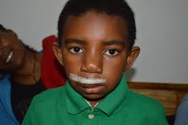 Medical Missions for Children (MMFC)