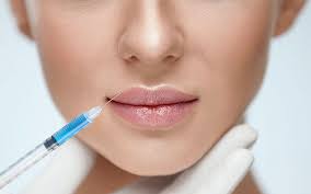 Lip augmentation procedures are for anyone who wants to improve the overall appearance of their lips, whether that be by plumping them, getting rid of fine lines, balancing uneven volume (in. How To Massage Juvederm Lumps Guide Vogue Freaks