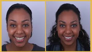 Exclusive Dental Turkey