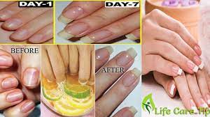 Aloe contains healing properties, which when applied to the nails, can strengthen, soften, and heal. How To Make Your Nails Grow Faster With This Diy Nail Growth Treatment