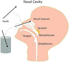 Rapid Fabrication Of Sterile Medical Nasopharyngeal Swabs By Stereolithography For Widespread Testing In A Pandemic Van Der Elst 2020 Advanced Engineering Materials Wiley Online Library
