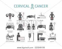 There are no signs or symptoms in the early stages. Cervical Cancer Vector Photo Free Trial Bigstock