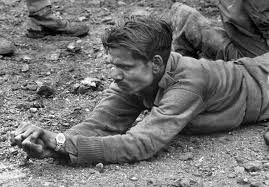 An ambulance driver from the Indian Army clenches his hands, indicating the  intense pain in his leg which has been almost completely blown off, during  the Korean War (1951 500 × 377) : r/HistoryPorn