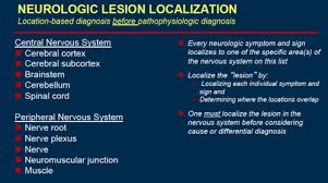 Image result for Neurologic Lesion Localization