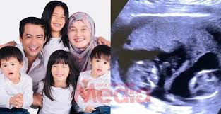 Halina mohd yunos recently shared that one of their first twin children, sheikh noah, has shown a slight attitude change recently. Bakal Terima Kembar Kali Ketiga Dr Halina Kongsi Video Ultra Sound Media Hiburan