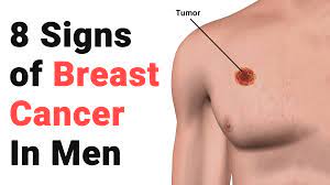 Some warning signs of breast cancer are— new lump in the breast or underarm (armpit). 8 Signs Of Breast Cancer In Men
