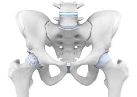 Coxarthrose Ursachen Symptome Und Therapie