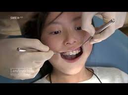Zahnspange Fur Kinder Erwachsene Die 20 Top Tipps Dental One