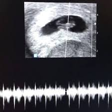 69 views11 months ago op. Dr Kaan Bozkurt Ginecologista E Obstetra Alsancak Izmir Facebook 1 108 Fotos