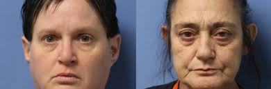 Two women arrested for allegedly providing marijuana to Lyons teen