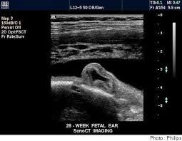 Echographie des faces antérieure, latérale, médiale du genou et échographie du creux poplité sous forme de cours vidéos en ligne. 28eme Semaine De Grossesse 30 Sa Doctissimo