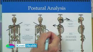 Postural Analysis Posture Assessment Kent Flip Chart
