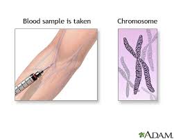 Karyotyping Mclaren Health Information Health