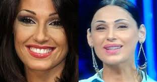 Listen now with amazon music : Anna Tatangelo A I Migliori Anni I Fan Insorgono Che Hai Fatto Al Viso L Huffpost