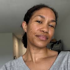 Reviewed: Dermapore+