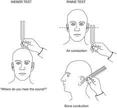 Image result for Tuning Fork Test