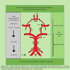 Image result for Posterior Circulation
