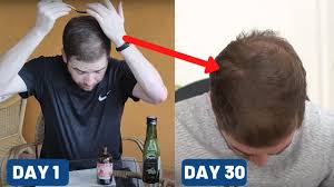 It is also great for men who long for fuller and stronger beards. Best Castor Oils For Hair Growth To Really Promote Thickness Beardoholic