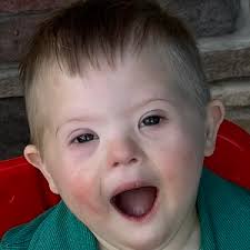 22nd Annual La Crosse Down Syndrome Awareness Walk 2024