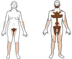 1, 2014 , 1:15 pm for all those brunettes wishing they were naturally blond, a small genetic change could have made all the difference. Why Beard Hair Is A Different Color Than Head Hair