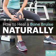 In this video, i tell you how to heal bruises fast with 4 easy steps! How To Heal A Bone Bruise Naturally Dr Axe