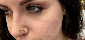 Best double nose piercings ideas.nose piercing is a trendy fashion nowadays. Parity Double Nose Ring Same Side Up To 66 Off