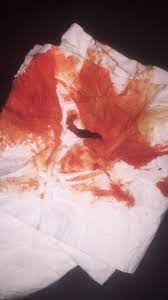 We did not find results for: Miscarriage At 5 Weeks Tmi Glow Community