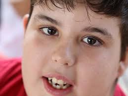 Disability and beauty: Rick Guidotti's photos challenge perceptions