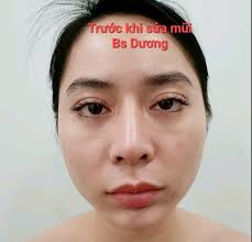 Thẩm Mỹ Viện Bs Bạch Dương
