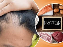 Has your hair turned very brittle lately? Protein And Hair Loss Importance Of Protein For Hair Growth Just Credible