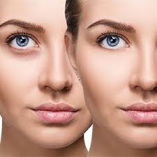 Amazon.com: Radha Beauty Eye Cream for Puffiness, Dark Circles, Wrinkles  and Bags