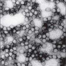 Marburg virus — virus marburg virus marburg … marburg virus disease — classification and external resources icd 10 a98.3 icd 9 078.89 … 1 Virus De Marburg Tomado De Wikipedia Org Wiki Virus De Marburg Download Scientific Diagram