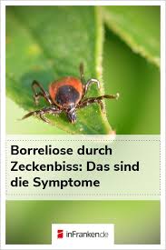 Borreliose Durch Zeckenbiss Das Sind Die Symptome Zeckenbiss Zecke Ratgeber Gesundheit