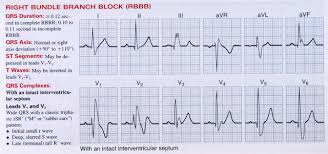 Kenapa? aku iseng juga dan kupencet hidungnya yang mancung. 5 Makanan Untuk Jantung Berdegup Laju Shaklieya Blog