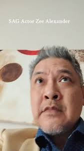 Zee Alexander Freckle Face Boy