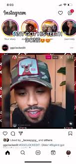 Ant got his teeth done 😍😍😍 ##bigteewitdatea #teewitdatea #viral  #viralvideo #nowthatstv #nowthatstvnetwork #fyp