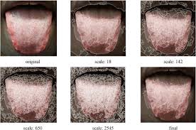 Advances In Automated Tongue Diagnosis Techniques