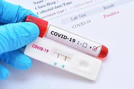 Test nhanh covid tại hà nội. Xet Nghiá»‡m Covid 19 Bao Nhieu Tiá»n Va Quy Trinh Thá»±c Hiá»‡n Medlatec